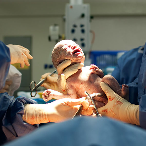 birth injury negligent childbirth infant brain damage medical negligence claims Swindon Personal Injury Solicitors