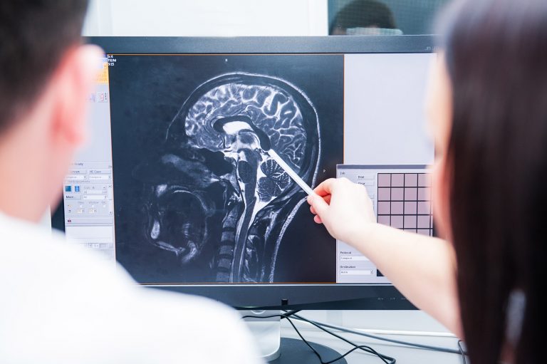 Doctors magnetic resonance image (MRI) injured brain, head injury Swindon Personal Injury Solicitors
